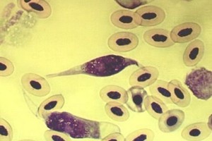 دانلود رايگان سوالات آزمون كارشناسي ارشد انگل شناسی پزشکی